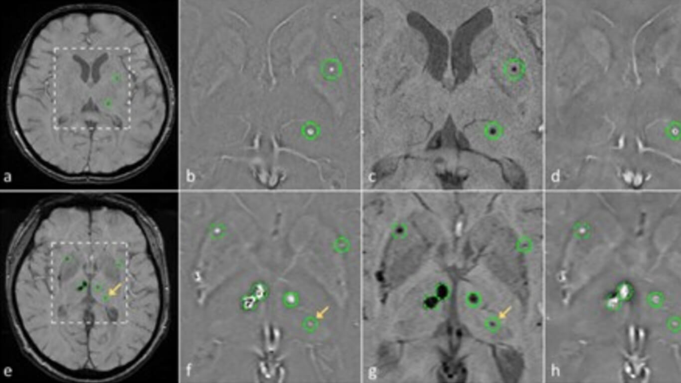 CMB SWI Deep Learning edit