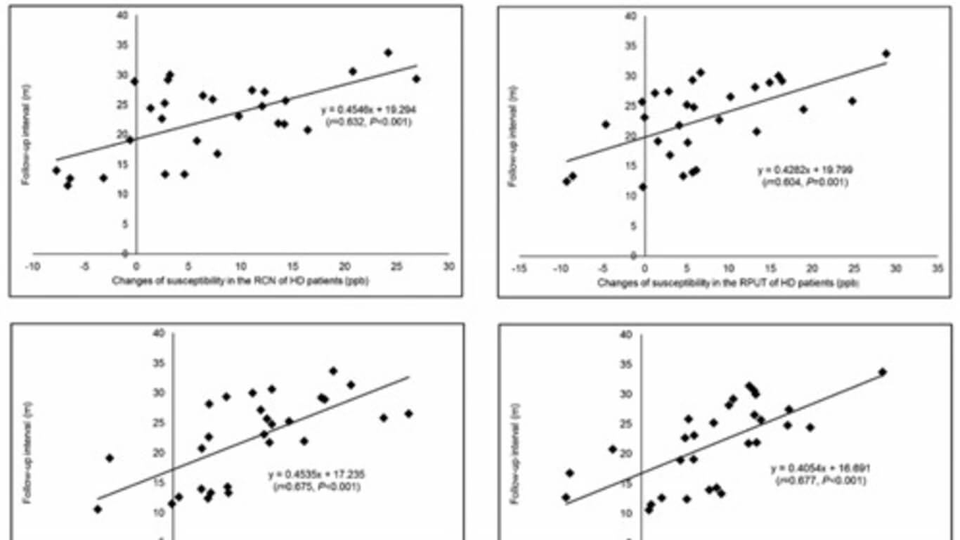 Iron Gray Matter Hemodialysis edit