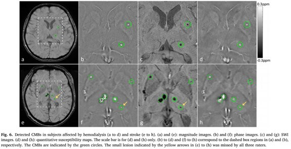 CMB SWI Deep Learning