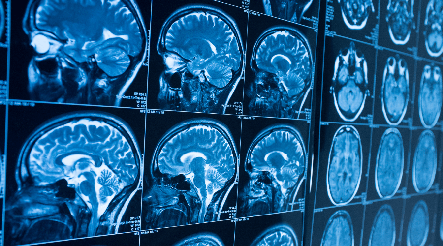 Copy of NeuroCovid Spintech TL Image