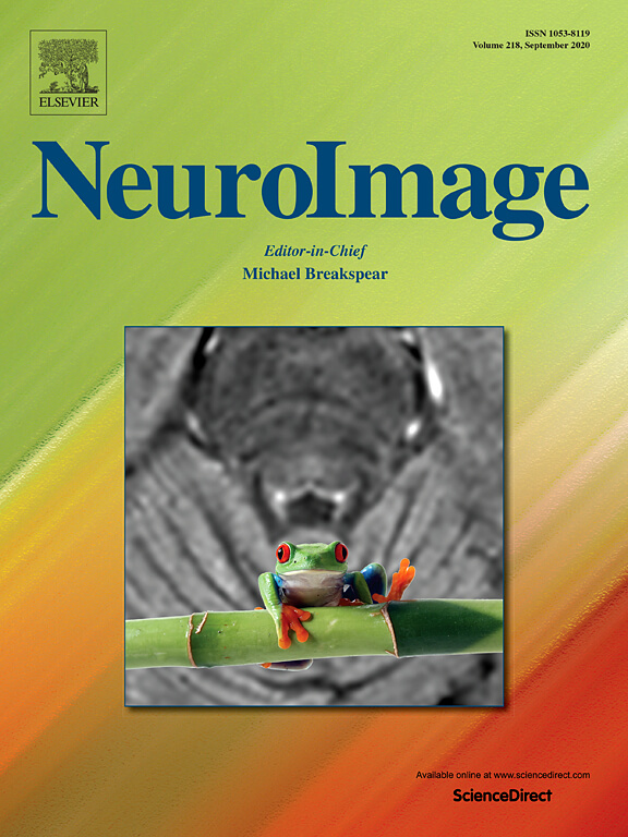 NeuroImage Sept 2020 Cover