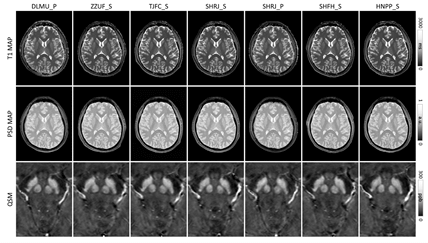 Neuroimaging and deep learning for brain stroke detection - A review of  recent advancements and future prospects - ScienceDirect