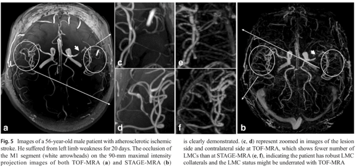 STAGE Angiography
