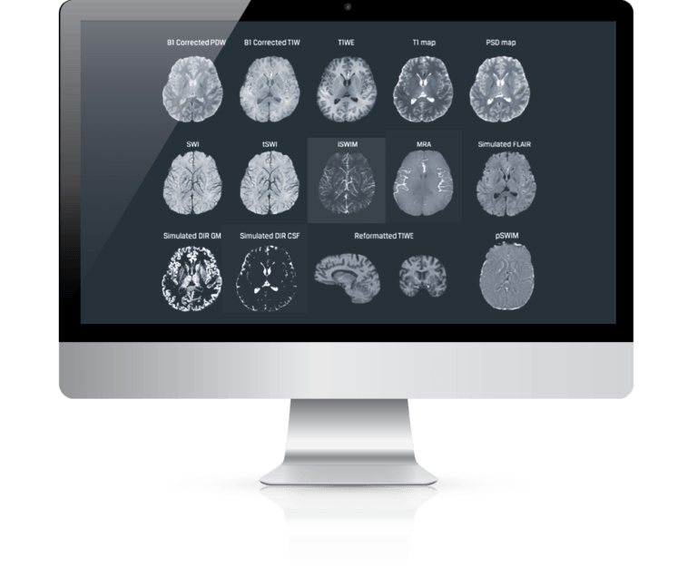 Image depicts MRI brain scans on a computer monitor