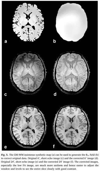 STAGE RF Inhomogeneities